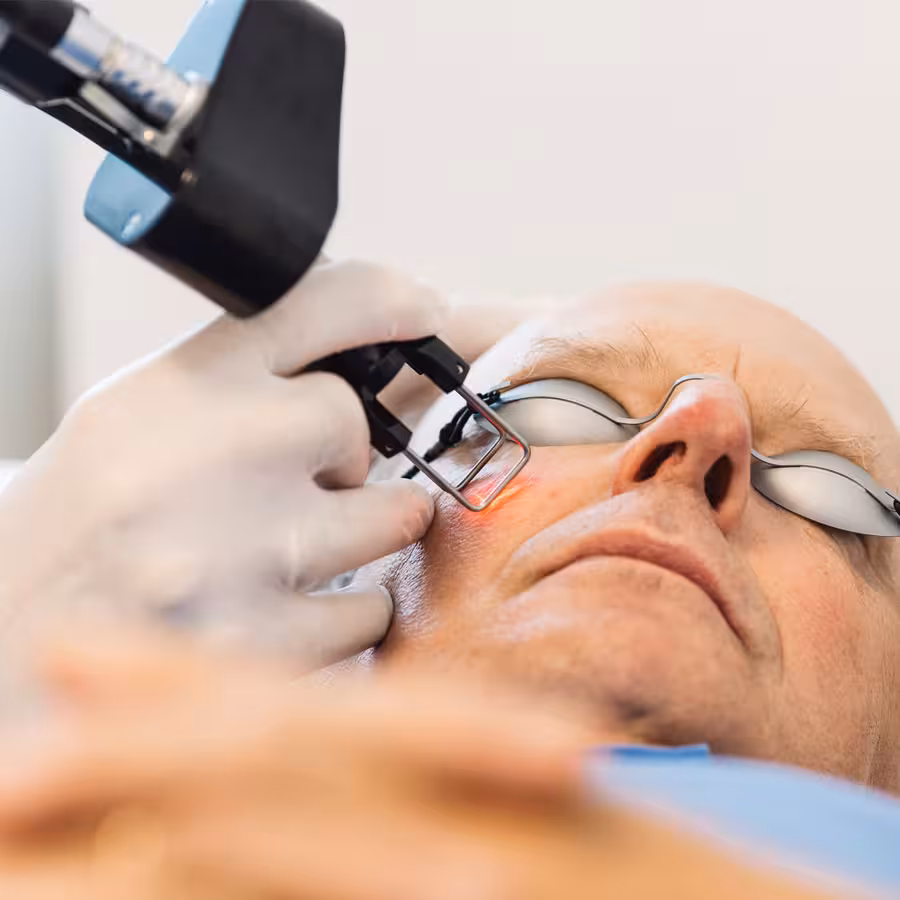 Rosazea Behandlung mit Laser