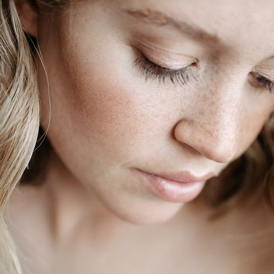 Botox Behandlung in der Dermatologie am Luegplatz Düsseldorf