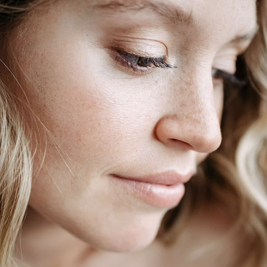 Hyaluron Unterspritzung Dermatologie am Luegplatz Düsseldorf